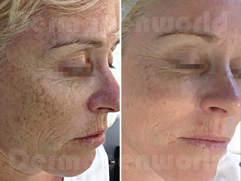 Before-&-After-Landing-Page-Ageing