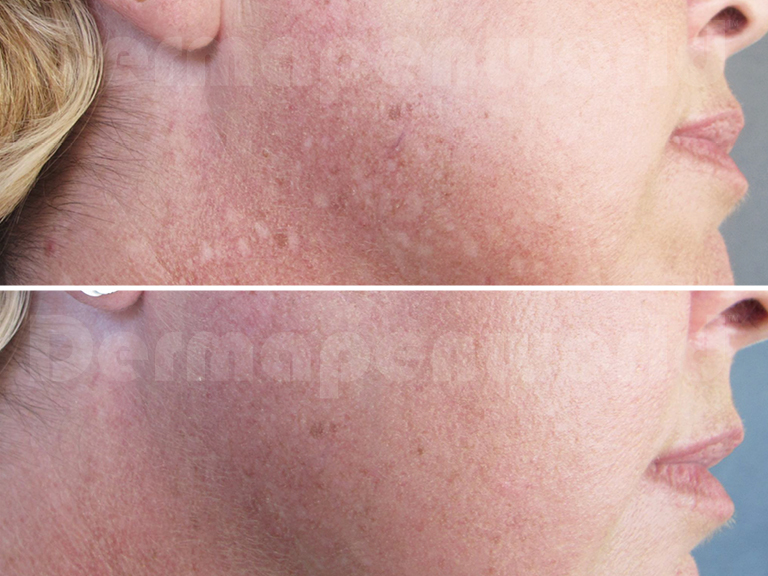 Before-&-After-Landing-Page-Pigmentation
